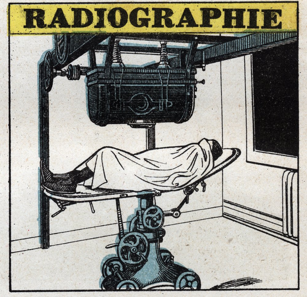 X-rays: X-ray apparatus by Anonymous Anonymous