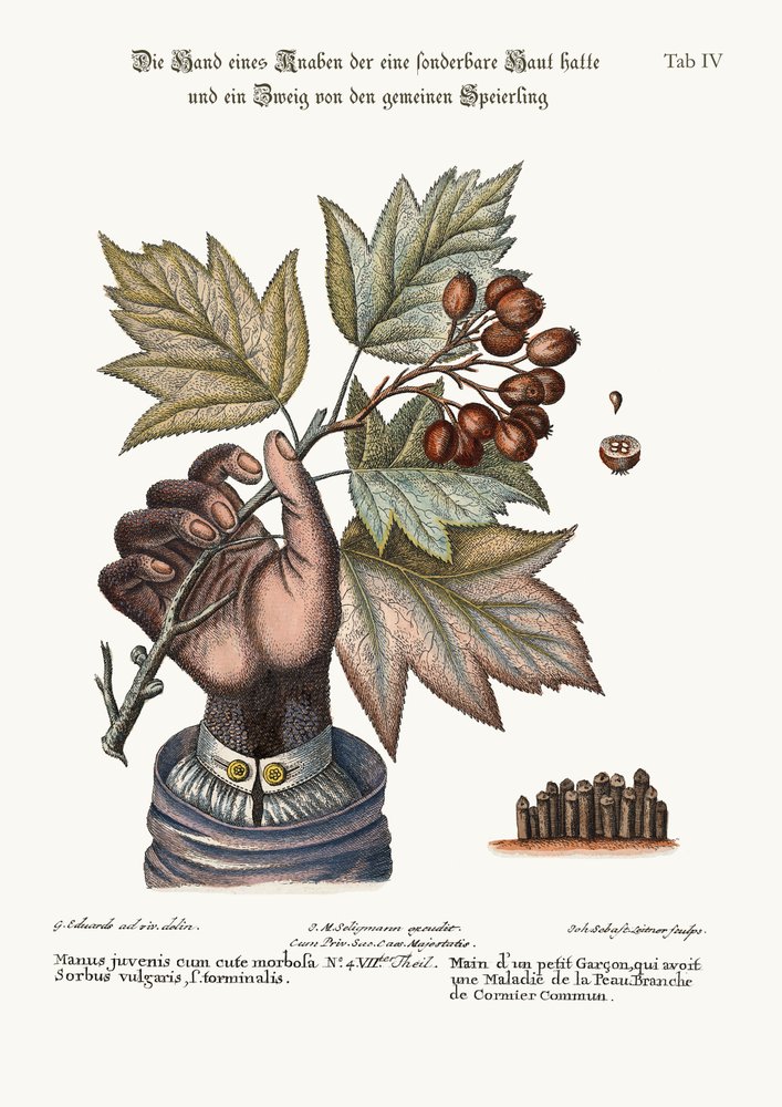 The Hand of a Boy with a Distempered Skin, and a Branch of the Common ...