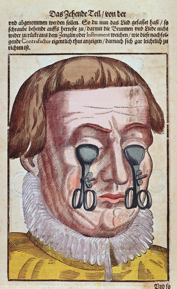 Treating an Eye Condition, from Ophthalmodouleia by Georg Bartisch, published in Dresden in 1583 by German School
