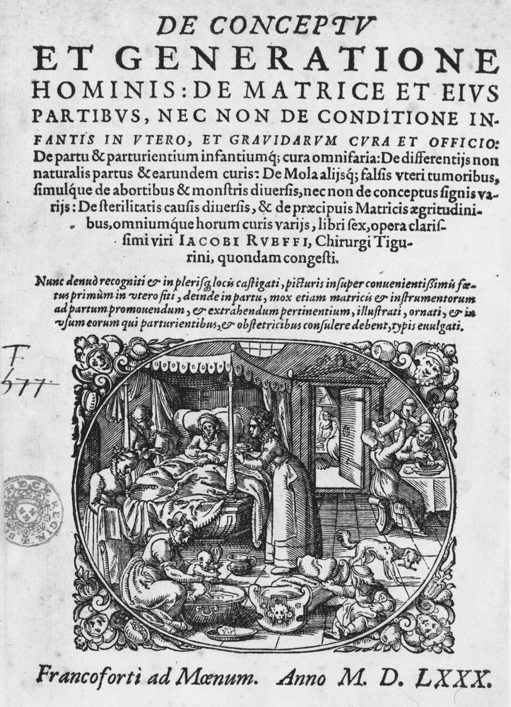 Childbirth Scene - in 'De Conceptu et Generatione Hominis...' by ...
