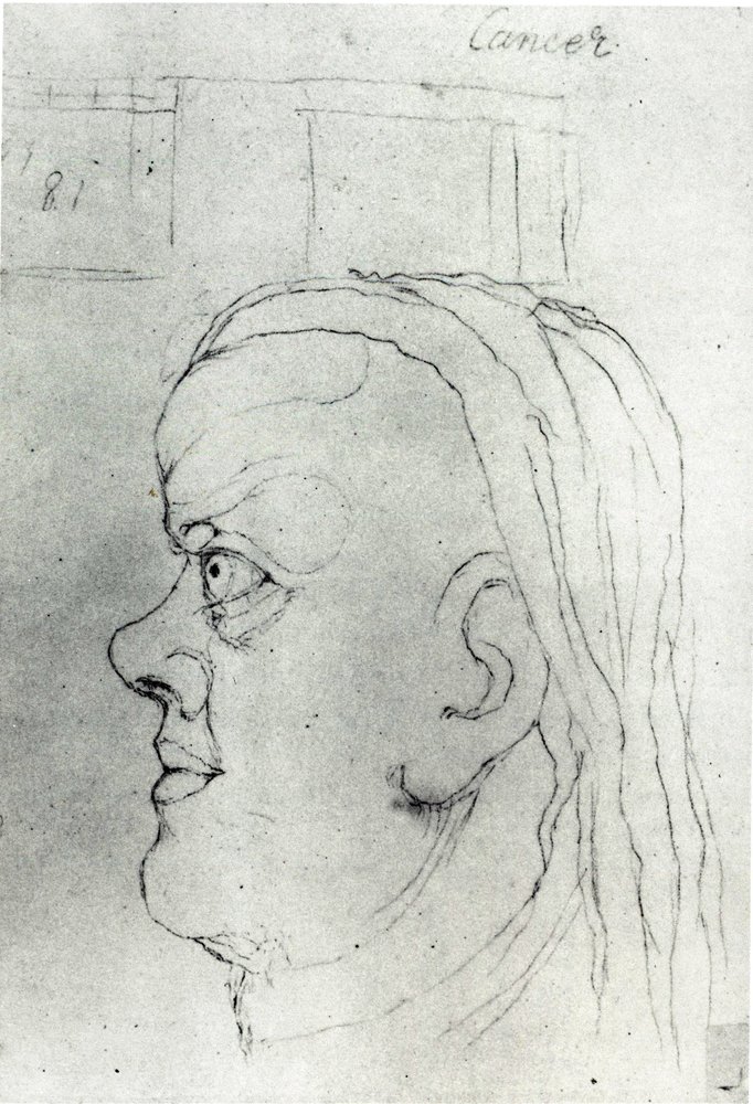 Head of Cancer by William Blake
