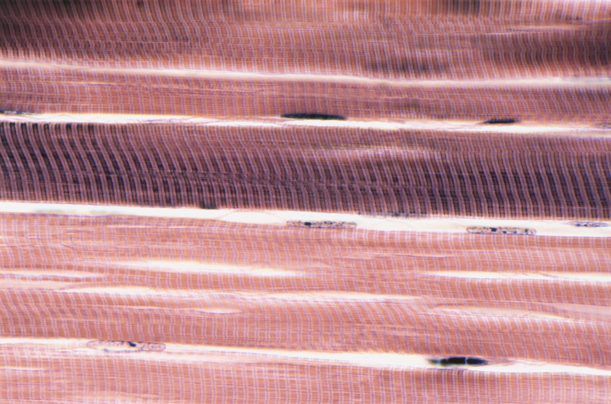 Skeletal Muscle Cells by Unknown