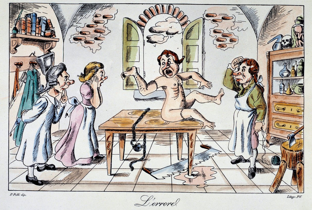 Surgical error: a satirical sticker representing the risks incurred by patients who are delivered to the hands of bad doctors, an example of an arm transplant instead of the leg. Engraving of the 19th century by Anonymous Anonymous