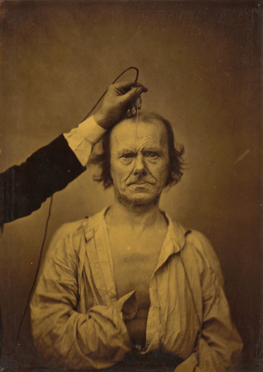 Attention left, Severity, aggression right by Duchenne de Boulogne