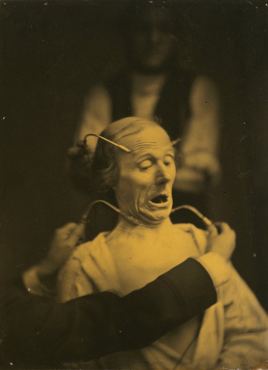 Expression of Terror by Duchenne de Boulogne