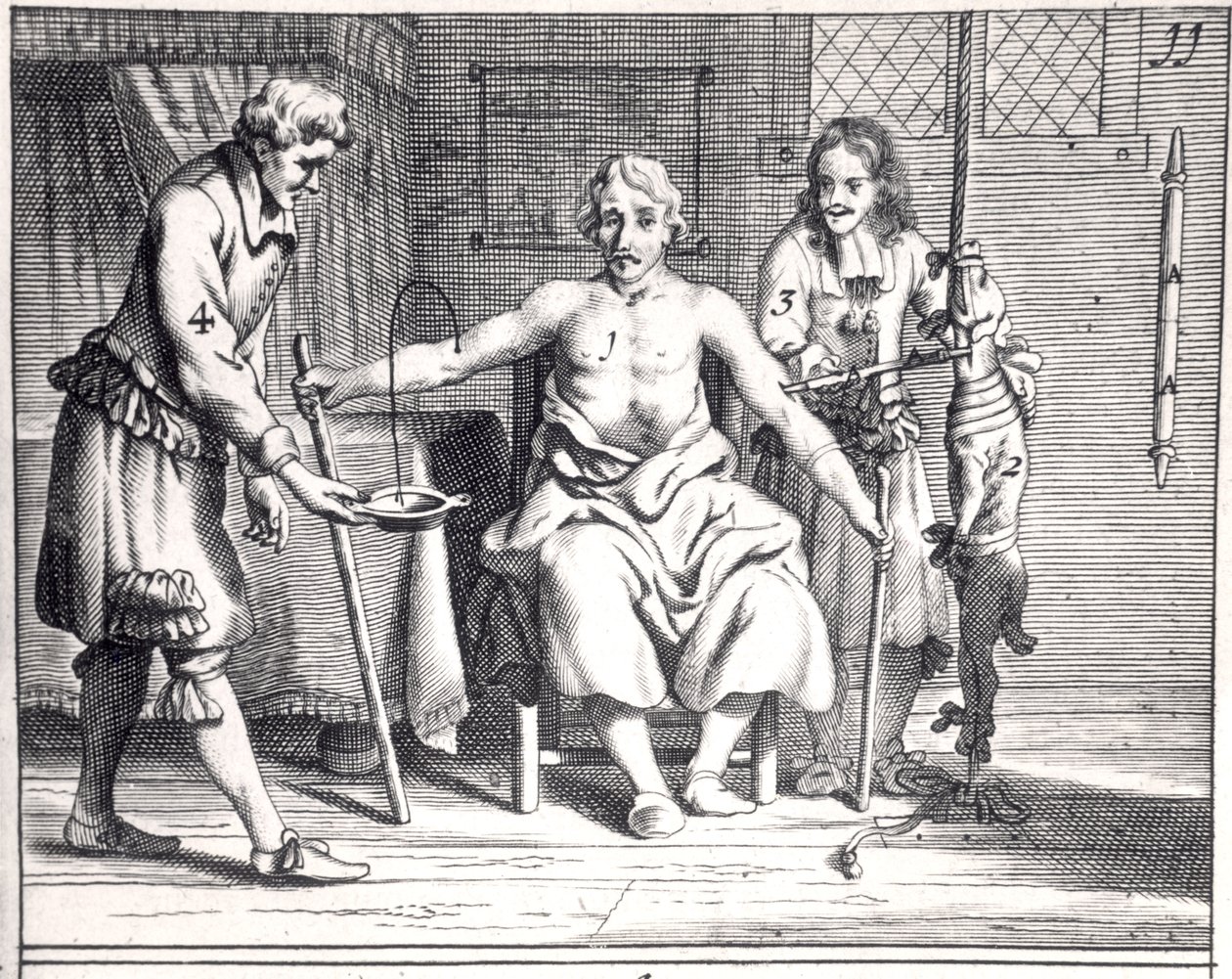 Blood transfusion from a dog, from Armamentarii Chirurgici by Johannes Schultes published in Amsterdam, 1671 by Dutch School
