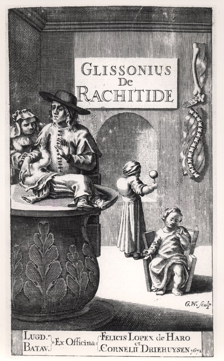 Francis Glisson (1597-1677) published in Leiden, 1671 by Dutch School