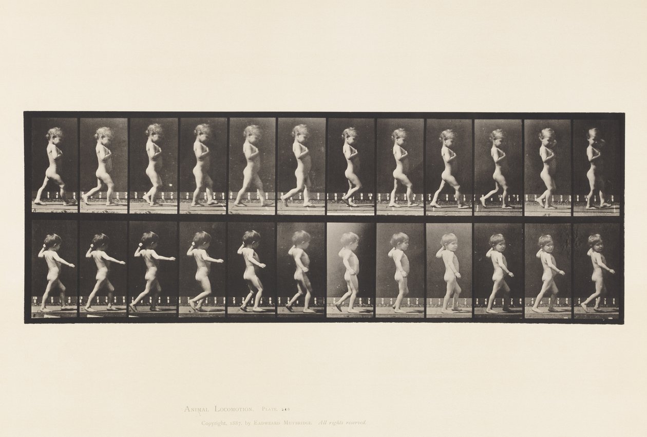 Bow Legs; Boy; Spinal Caries; Girl Walking by Eadweard Muybridge