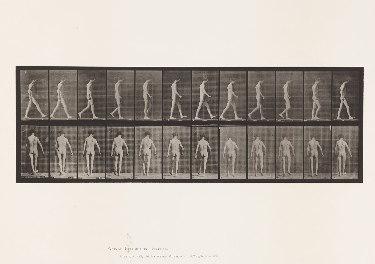 Locomotor Ataxia; Walking by Eadweard Muybridge