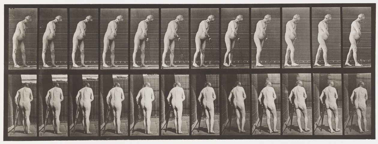 Hemiplegia; Walking with Crutch by Eadweard Muybridge