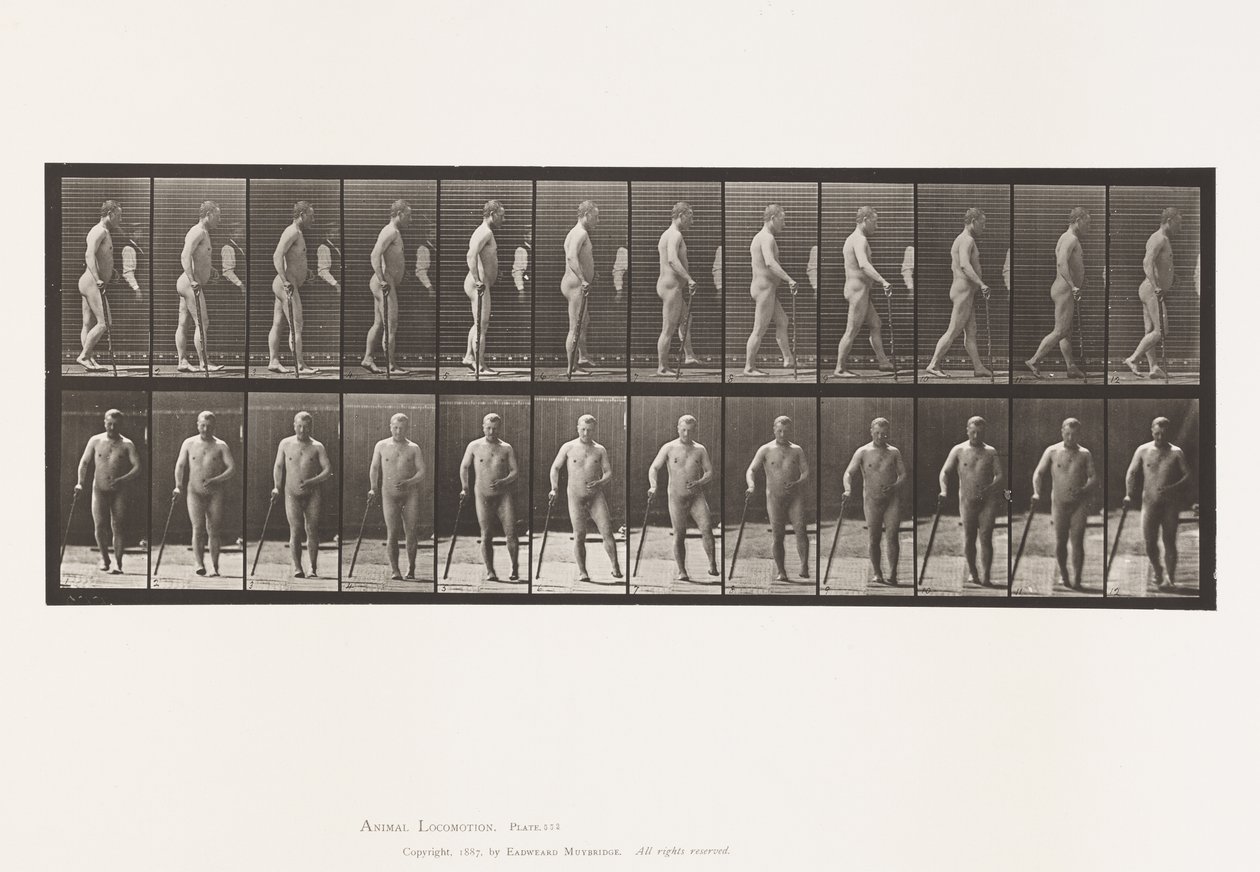 Hemiplegia; Walking with Cane by Eadweard Muybridge