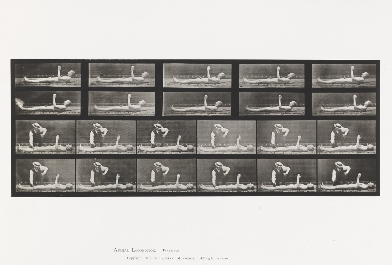 Plate 556. Local Chorea; A, B, While Lying by Eadweard Muybridge