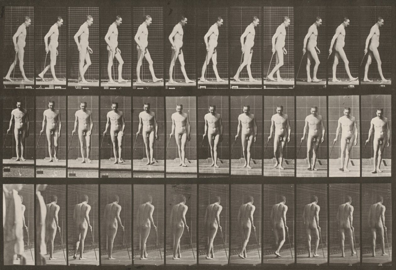 Plate Number 559. Partial Paraplegia, Walking with Cane by Eadweard Muybridge