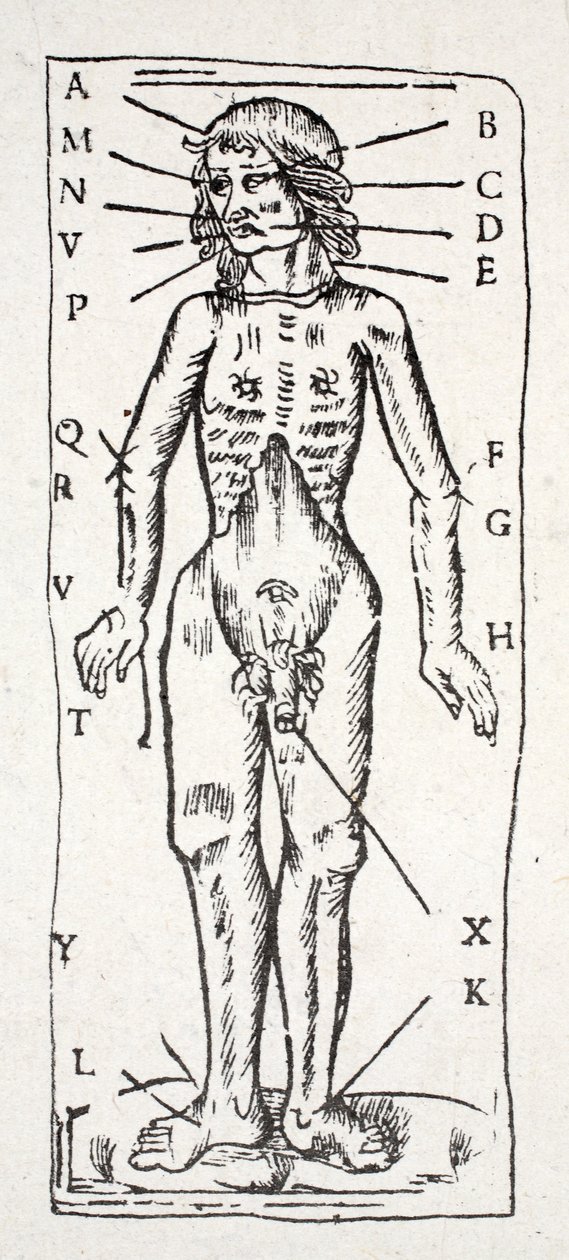 A Body Which Has Been Under the Scalpel, with Veins Labelled by English School