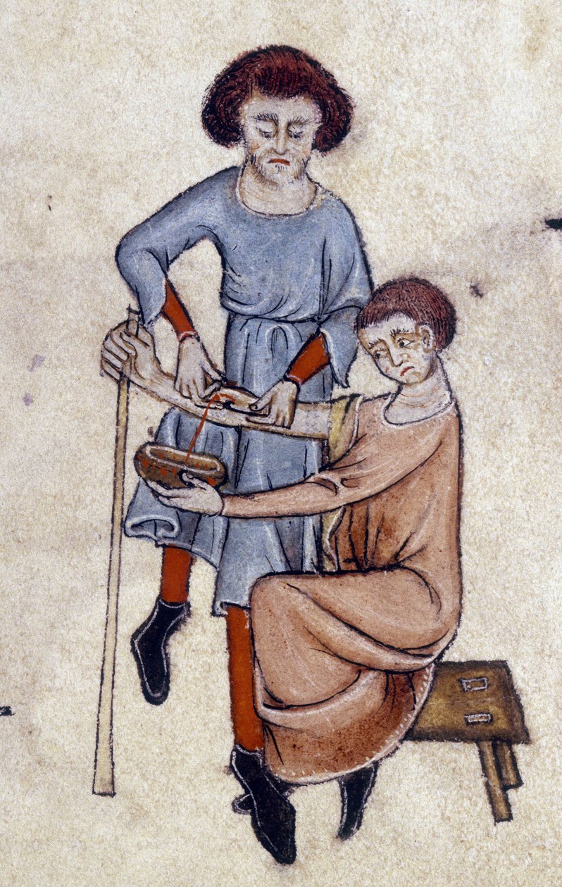 Blood Letting, from the Luttrell Psalter, c.1325-35