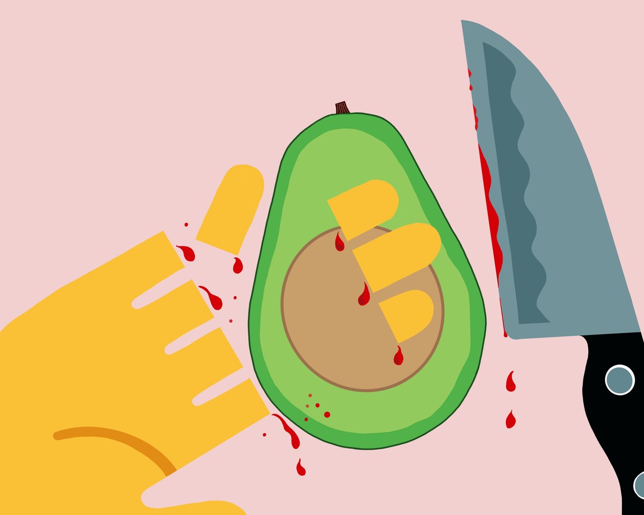 Avocado Hand by Evan Sklar