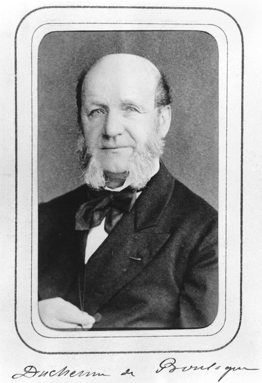 Guillaume Benjamin Duchenne de Boulogne by French Photographer