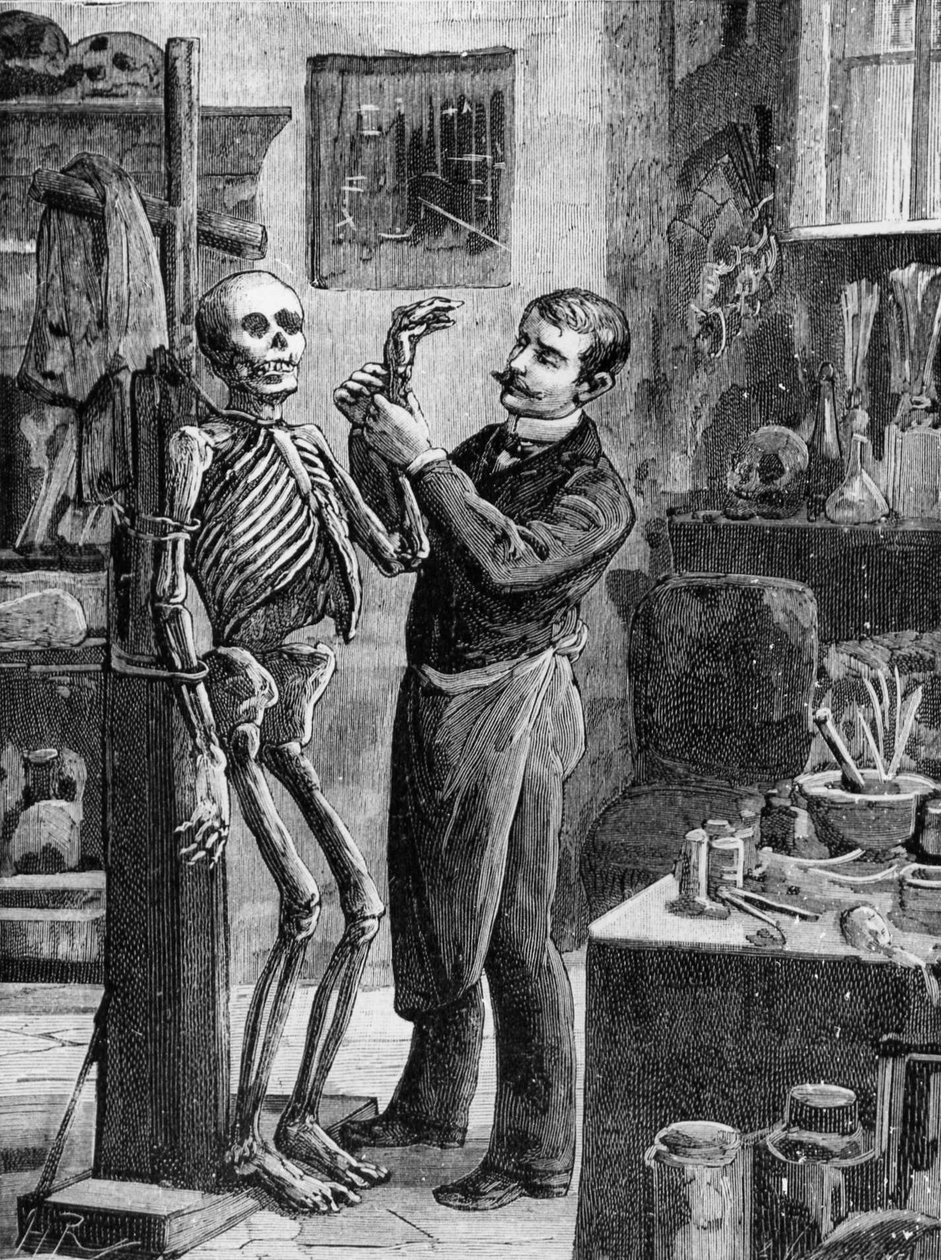 Case Gouffé: La reconstruction imaginaire du cadavre Gouffé par le dr Lacassagne - in 