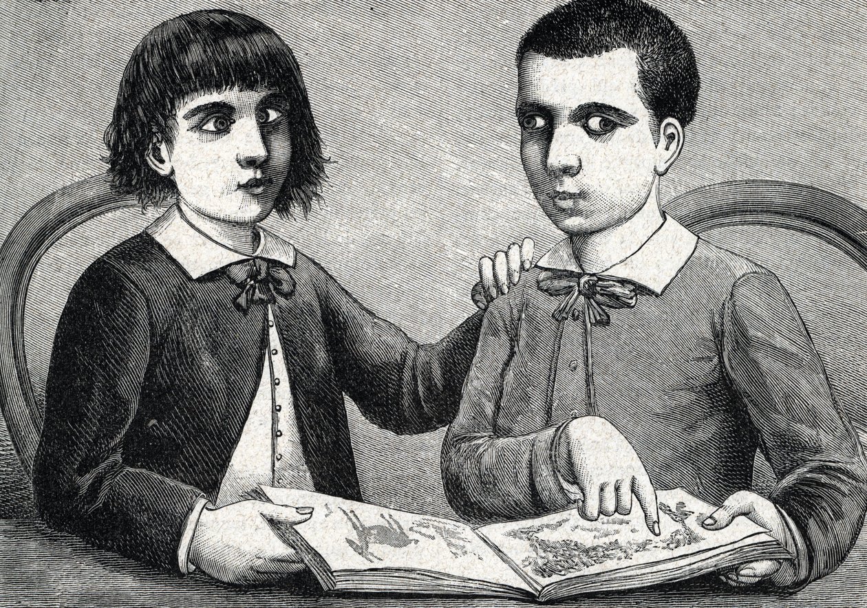 Children with convergent and divergent strabismus or crossed eyes (engraving) 1888 by French School