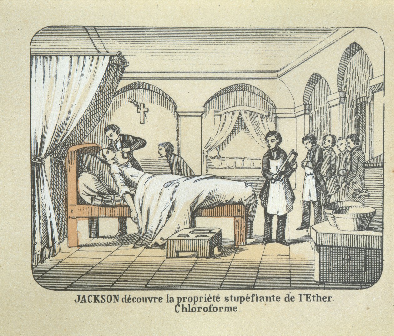 Dr Charles Jackson discovers the anaesthetic qualities of ether by French School