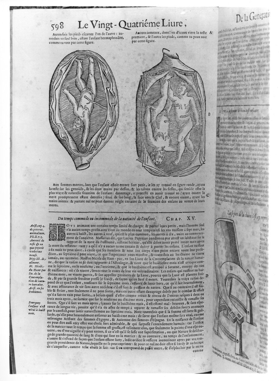 Foetus, Illustration from Oeuvres by Ambroise Pare (1509-90) Published in Lyon, 1641 by French School