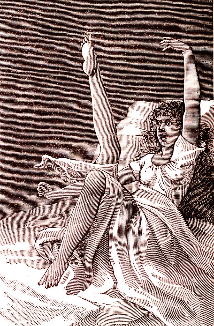 Hysteria, an extremely mental phenomenon, psychoses and psychoneurosis. 1887 by French School