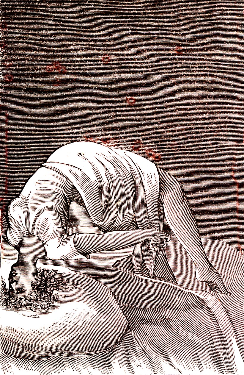 Hysteria, Mental and Nervous Disorder, Arising from Intense Anxiety. 1887 by French School
