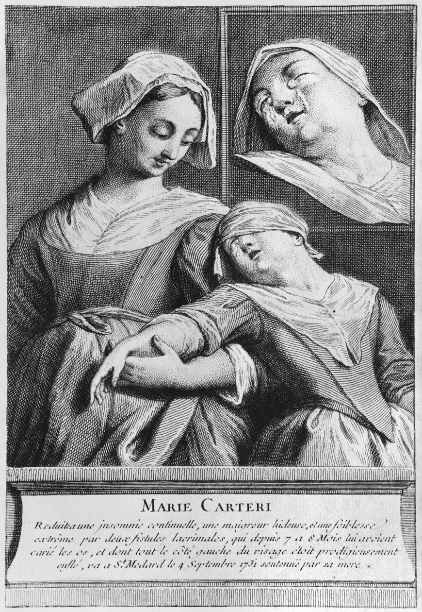 Miraculous healing of a blind woman, Marie Carteri, on the tomb of Deacon Francois de Paris at the parish cemetery Saint-Medard in Paris by French School