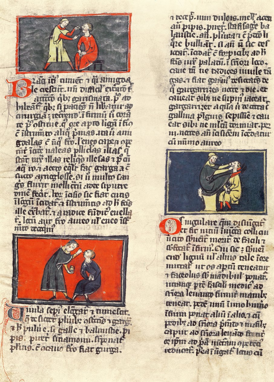 Ms H 89 fol.16v Dental Surgery, from an Edition of the 