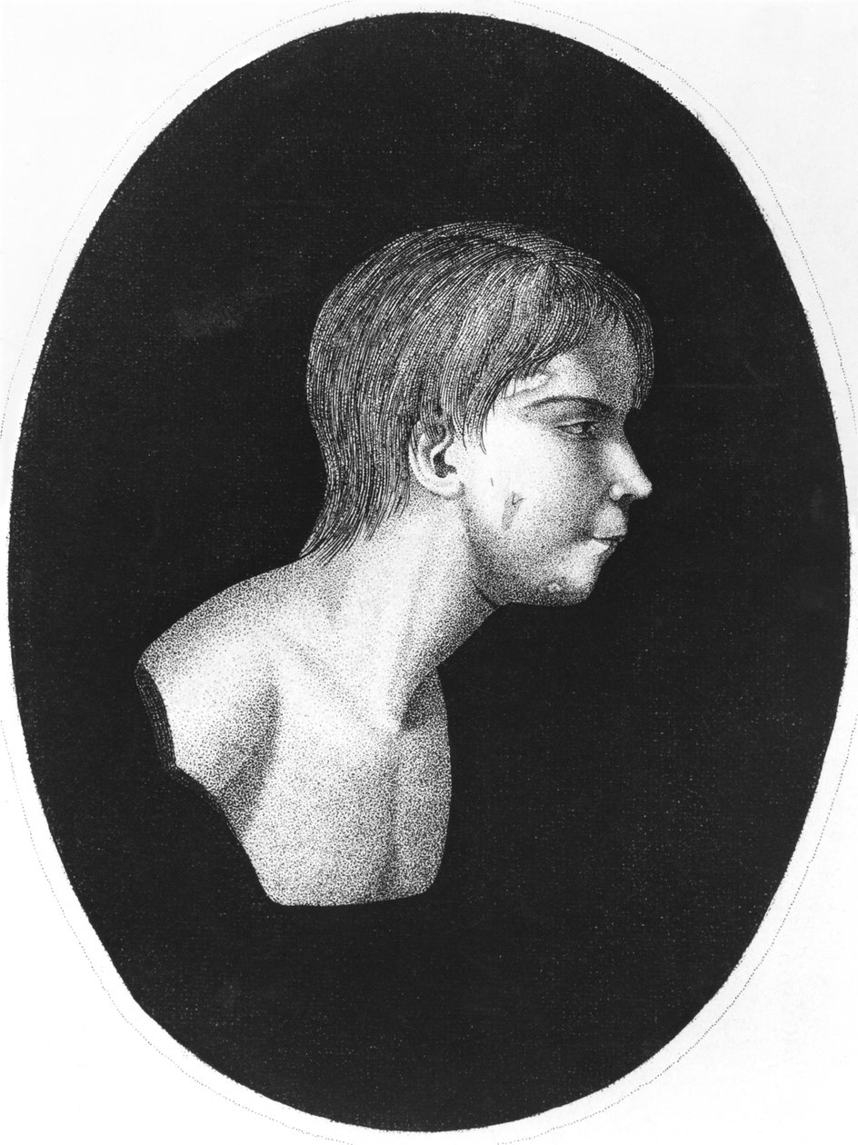 Victor of Aveyron, Frontispiece of De l
