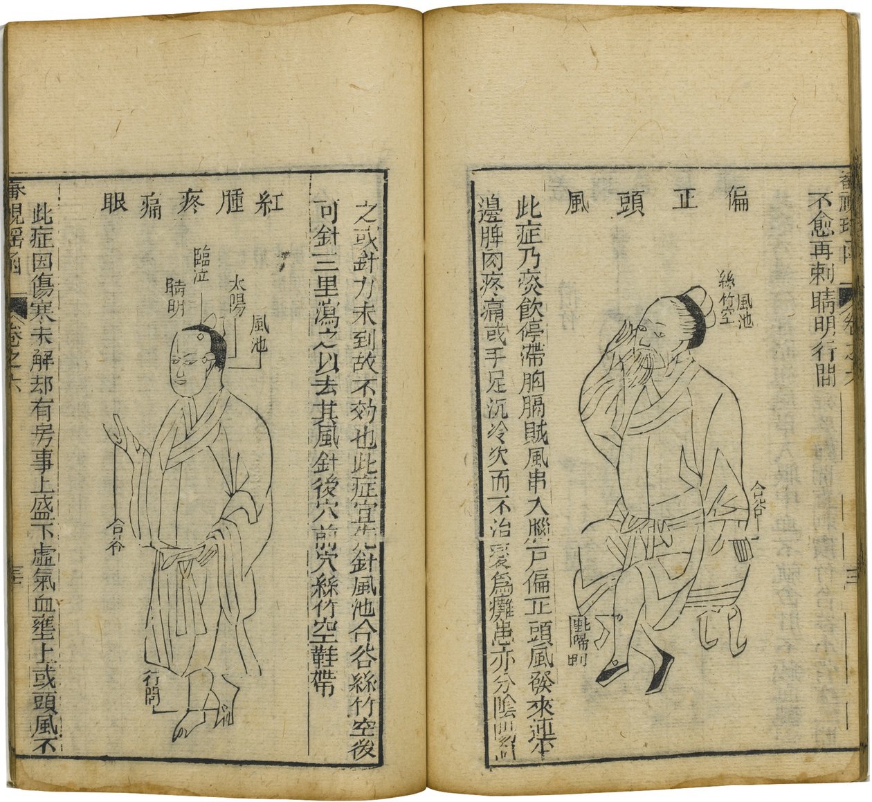 Shen Shi Yao Han: A Precious Book of Ophthalmology, 1644 by Fu Renyu