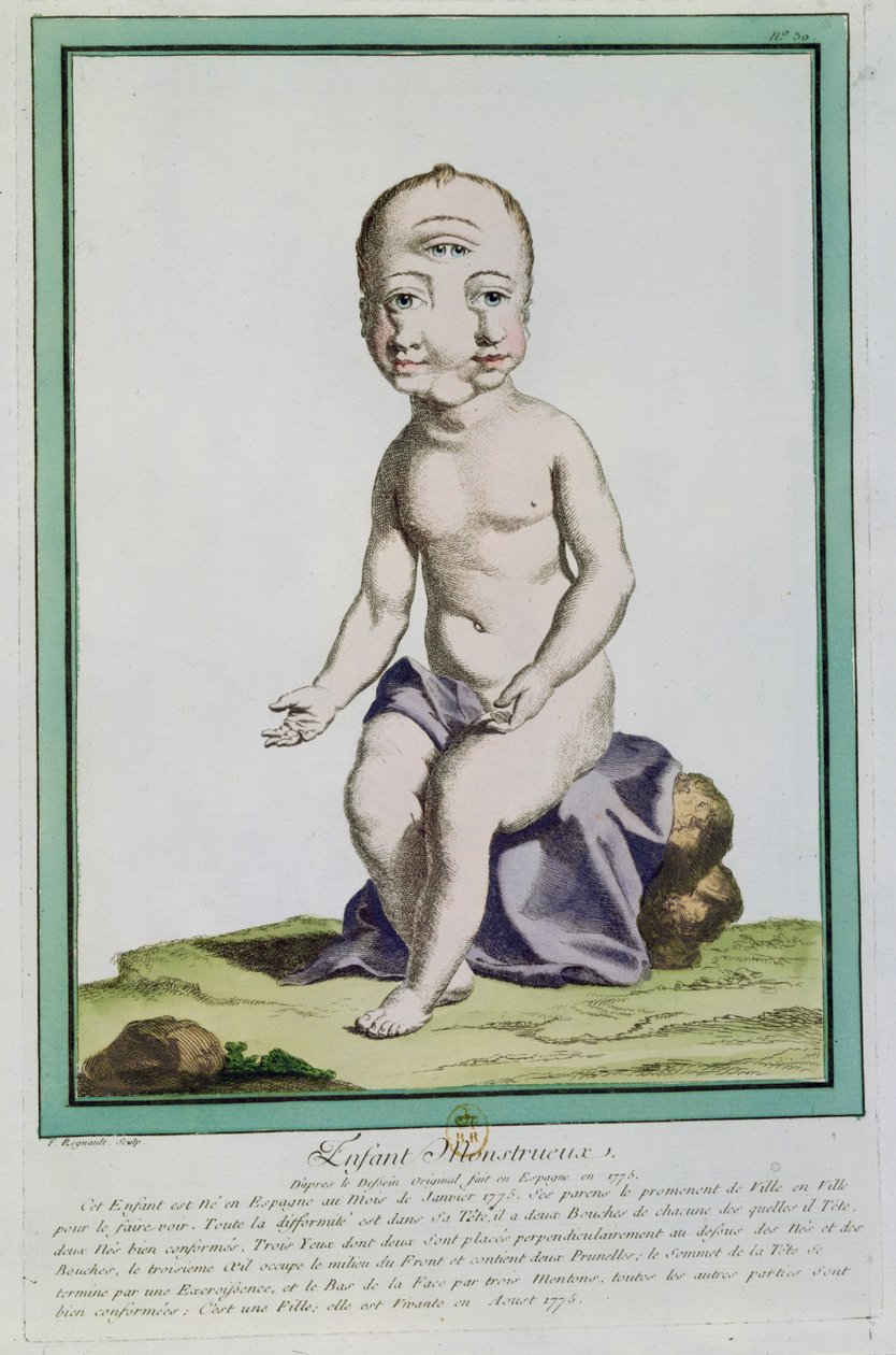 Child with a Deformed Head, from 