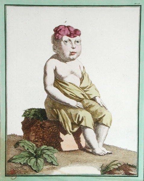 Child with half a head, from 