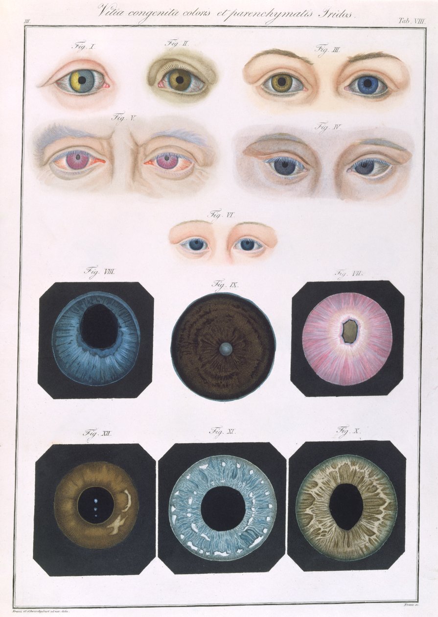 Description of congenital eye anomalies, from Klinische Darstellungen der Krankheiten und Blidungsfehler des Menschlichen Auges, by Friedrich August von Ammon, 1838 by German School