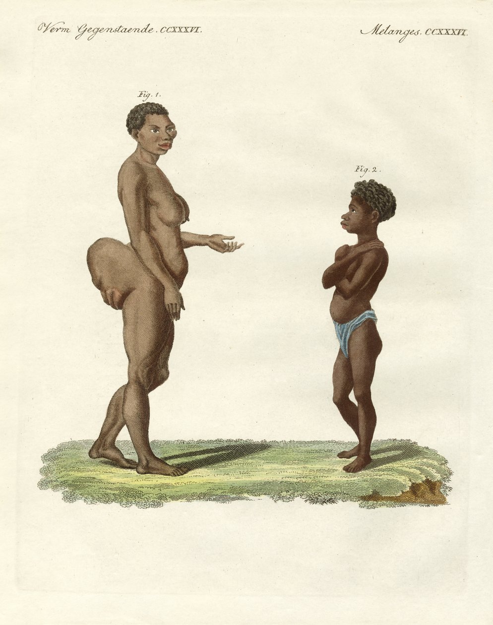 Strange human varieties by German School