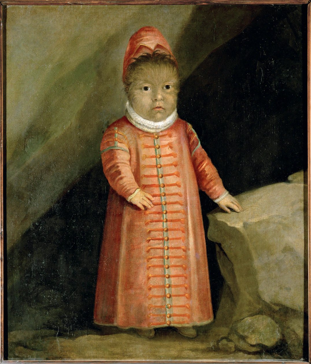 The Son of Petrus Gonzalvus Examined in 1596 by German School