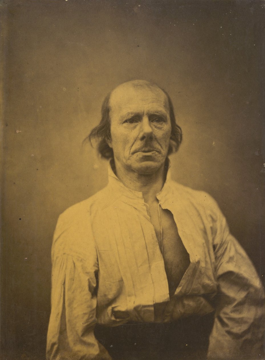 Face in Repose, 1854-1856, Printed 1862 by Guillaume Benjamin Armand Duchenne de Boulogne