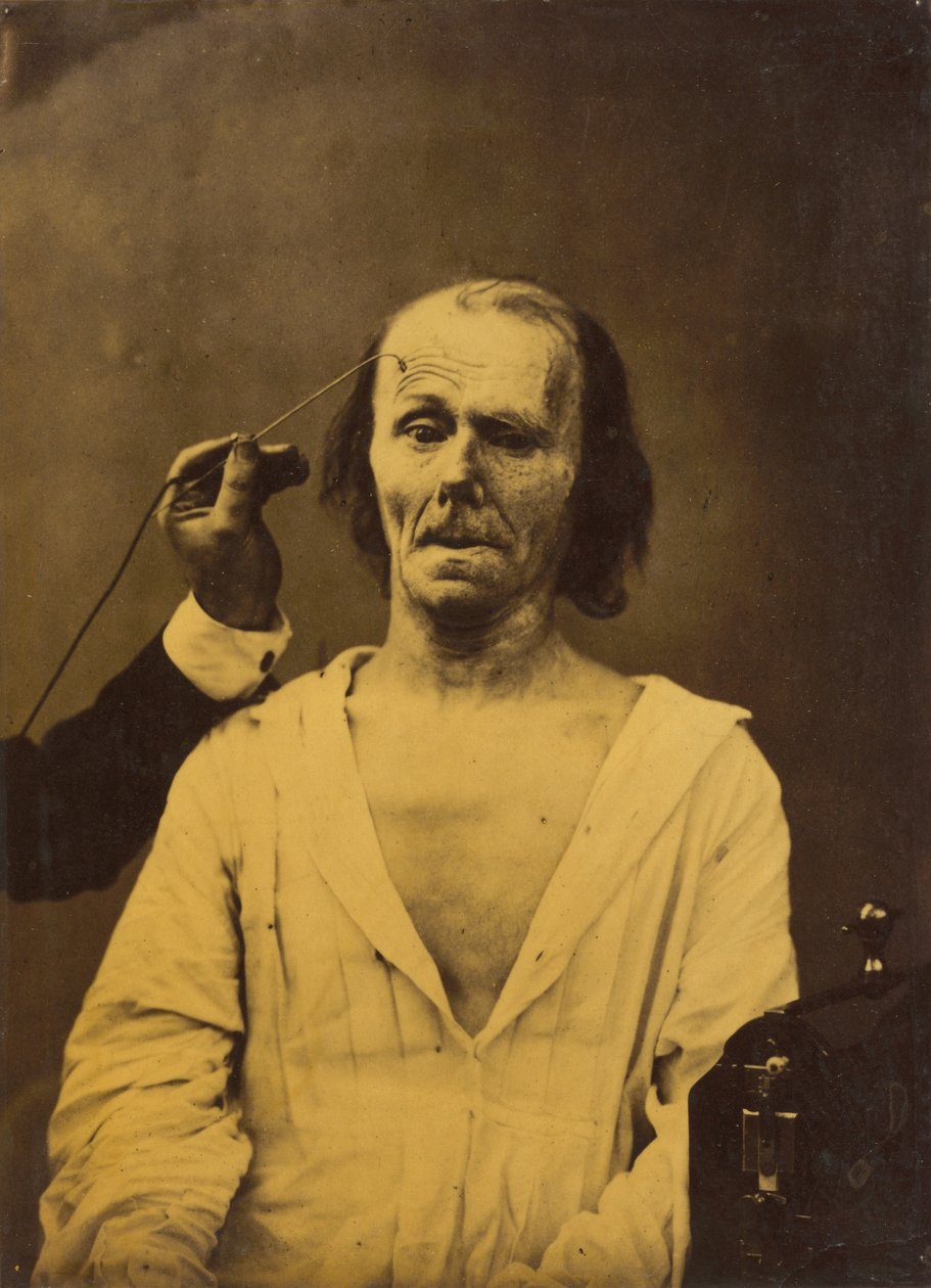 A Relaxed Face (left); Profound Attention (right) by Guillaume Benjamin Amant Duchenne