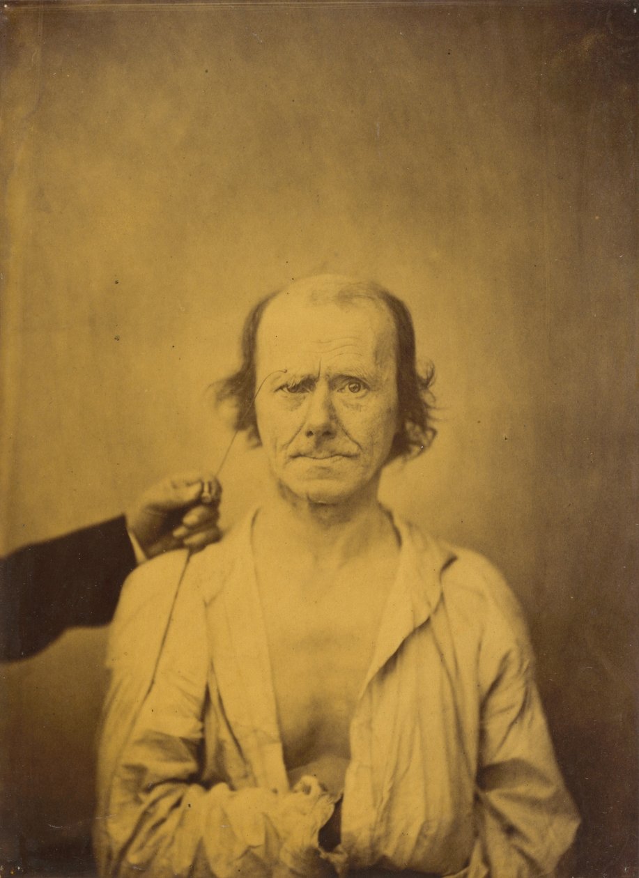 Attention (left); Reflection (right) by Guillaume Benjamin Amant Duchenne