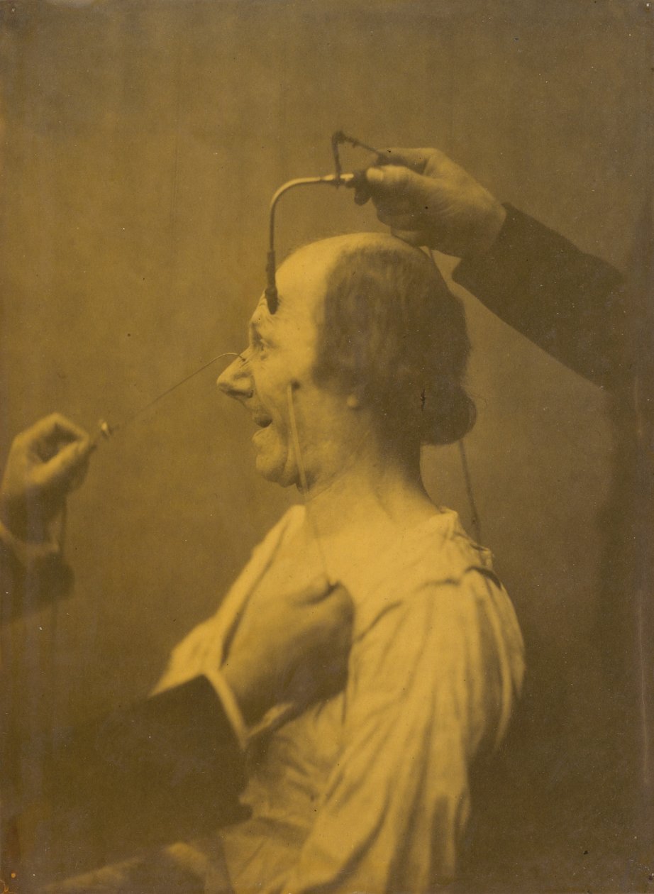 The Attention Attracted by an Object that Provokes Lascivious Ideas and Desires by Guillaume Benjamin Amant Duchenne