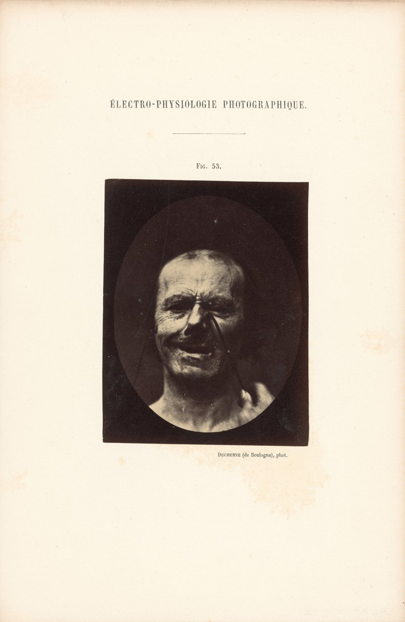 Electro-Physiological Photography, Figure 53 by Guillaume Benjamin Duchenne