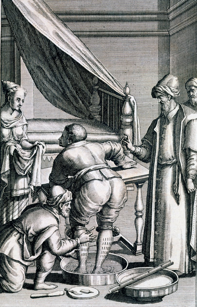 Bloodletting in the legs, from Medicina Aegyptiorum by Prospero Alpini by Italian School