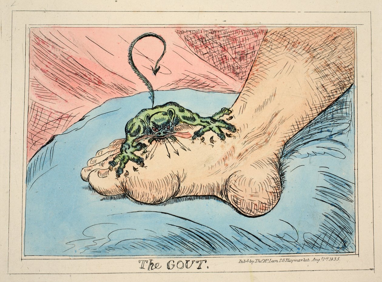 The Gout by James Gillray
