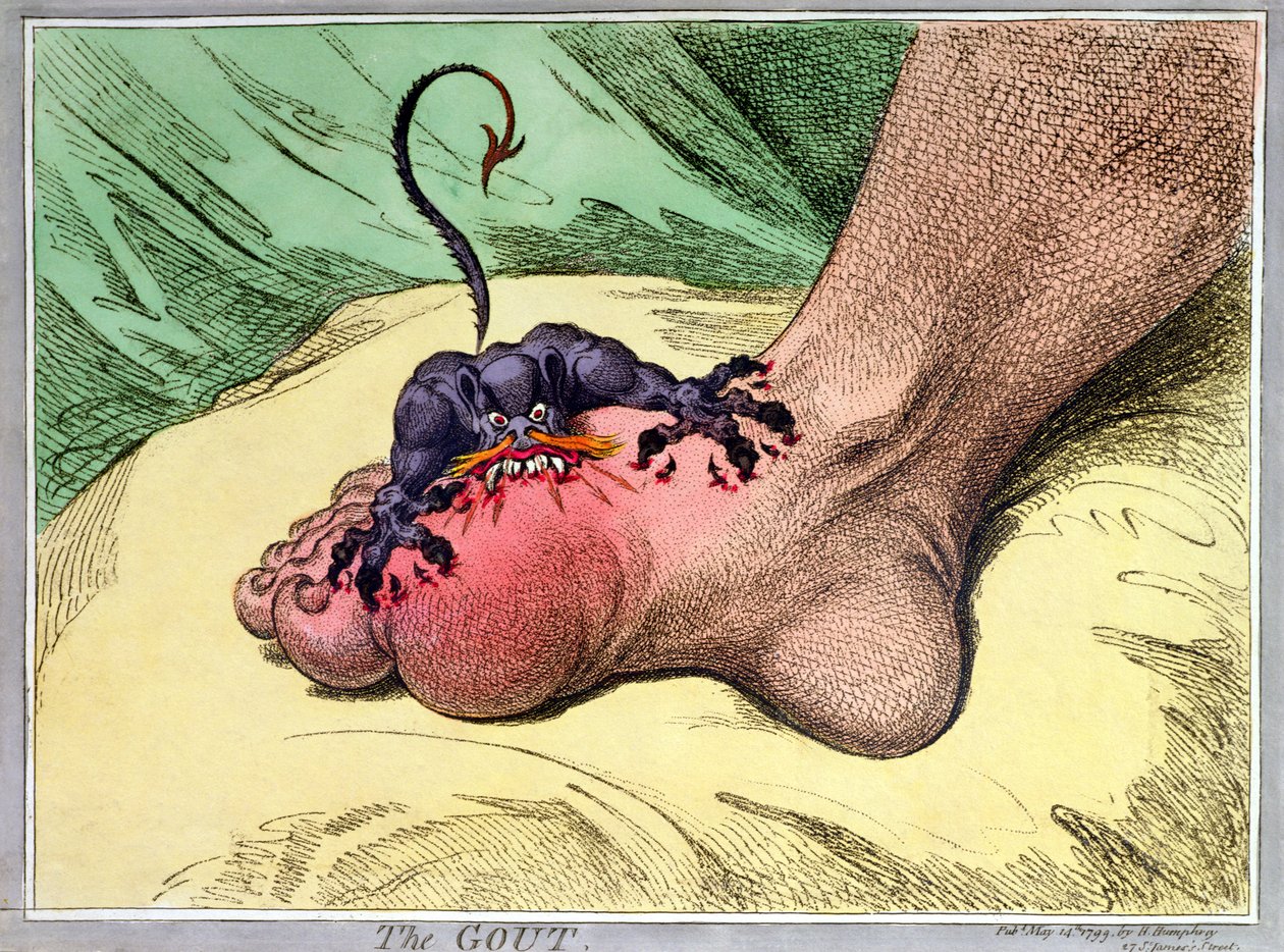 The Gout, published by Hannah Humphrey in 1799 by James Gillray