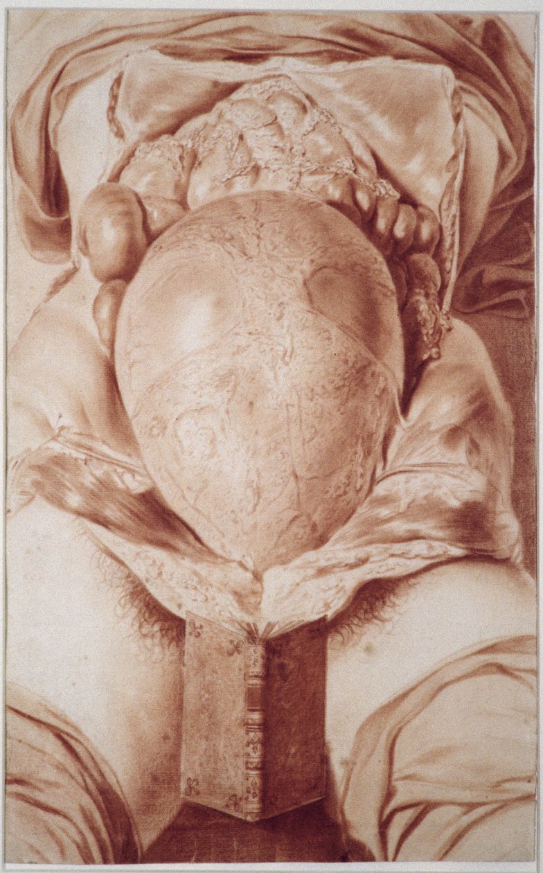 Drawing from William Hunter