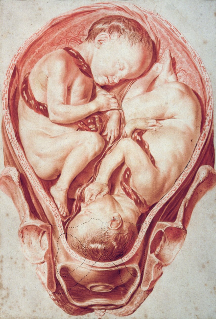 Ms Hunter 654 Plate 10 Drawing from a Set of Obstetrical Drawings for William Smellie