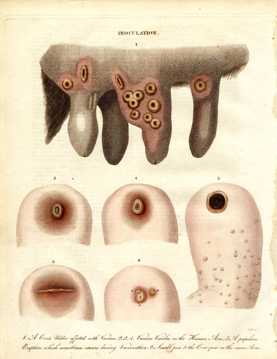 Inoculation and Disease Progression by John Pass