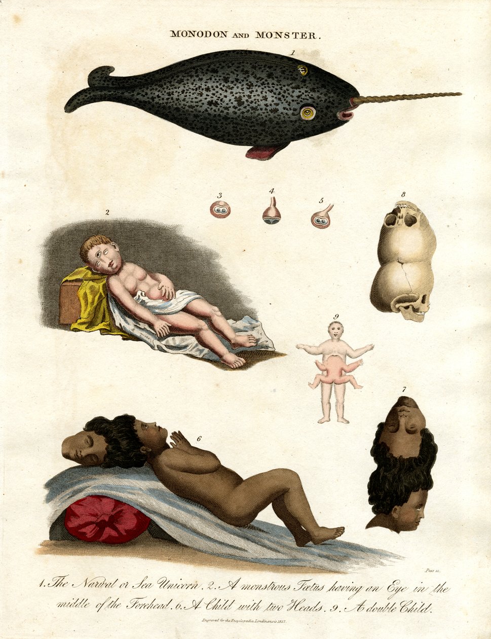 Narwhal and Malformations by John Pass