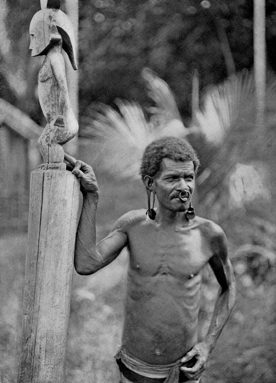 Malformation of the Ears, Solomon Islands, 1920 by John Watt Beattie