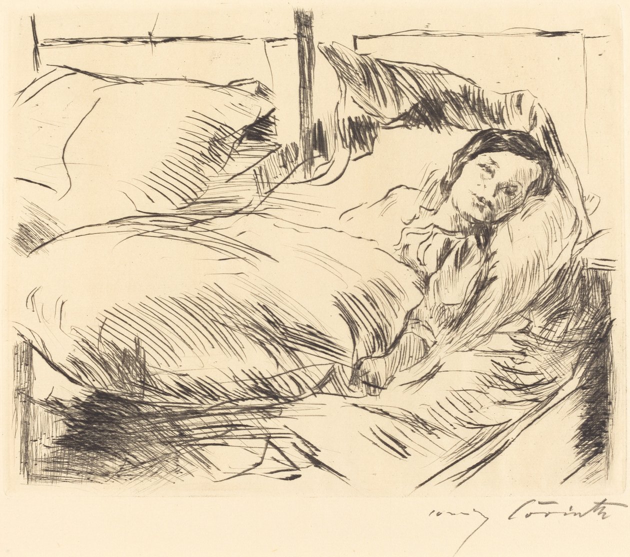 The Sick Child, 1918 by Lovis Corinth